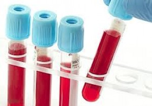 Thông báo chào giá các mặt hàng hóa chất Miễn dịch 2 tại  Bệnh viện Đa khoa khu vực miền núi phía Bắc Quảng Nam